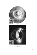 Видеть лучше. Как сохранить зрение — фото, картинка — 14