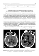 Ишемический инсульт и нетравматическое внутричерепное кровоизлияние. Формализованные протоколы описания РКТ- и МРТ-исследований — фото, картинка — 6