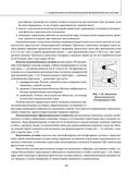 Остеохондроз позвоночника. Методики немедикаментозного лечения болей в спине — фото, картинка — 18