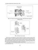 Остеохондроз позвоночника. Методики немедикаментозного лечения болей в спине — фото, картинка — 19