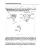Остеохондроз позвоночника. Методики немедикаментозного лечения болей в спине — фото, картинка — 21