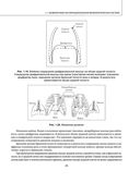 Остеохондроз позвоночника. Методики немедикаментозного лечения болей в спине — фото, картинка — 24