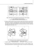 Остеохондроз позвоночника. Методики немедикаментозного лечения болей в спине — фото, картинка — 28
