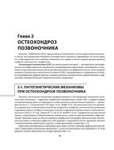 Остеохондроз позвоночника. Методики немедикаментозного лечения болей в спине — фото, картинка — 35