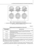 Остеохондроз позвоночника. Методики немедикаментозного лечения болей в спине — фото, картинка — 36