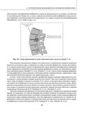 Остеохондроз позвоночника. Методики немедикаментозного лечения болей в спине — фото, картинка — 38