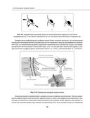 Остеохондроз позвоночника. Методики немедикаментозного лечения болей в спине — фото, картинка — 45