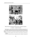 Остеохондроз позвоночника. Методики немедикаментозного лечения болей в спине — фото, картинка — 79