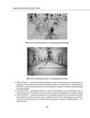 Остеохондроз позвоночника. Методики немедикаментозного лечения болей в спине — фото, картинка — 89