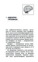 Болезни щитовидной железы. Как жить с гипо- и гипертиреозом и что делать с дисбалансом гормонов — фото, картинка — 22
