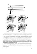 Основы колопроктологии — фото, картинка — 19
