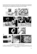 Основы колопроктологии — фото, картинка — 21