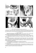 Основы колопроктологии — фото, картинка — 22