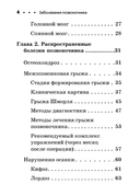 Заболевания позвоночника. Карманный справочник — фото, картинка — 2