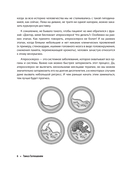 Атеросклероз. Всё о лечении, диете и поддержании здоровья сосудов — фото, картинка — 3